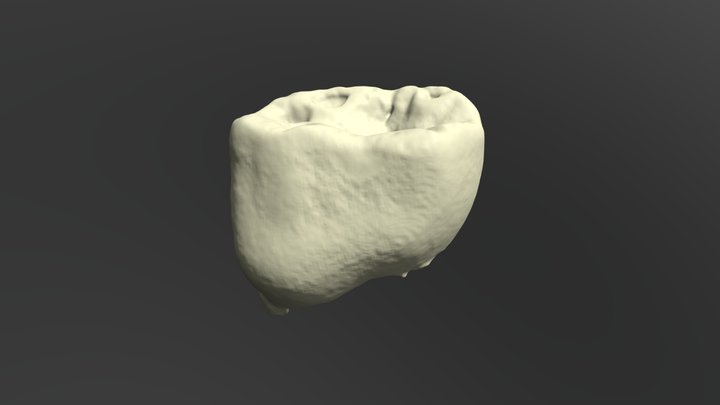 Deciduous Mandibular Molar 3D Model