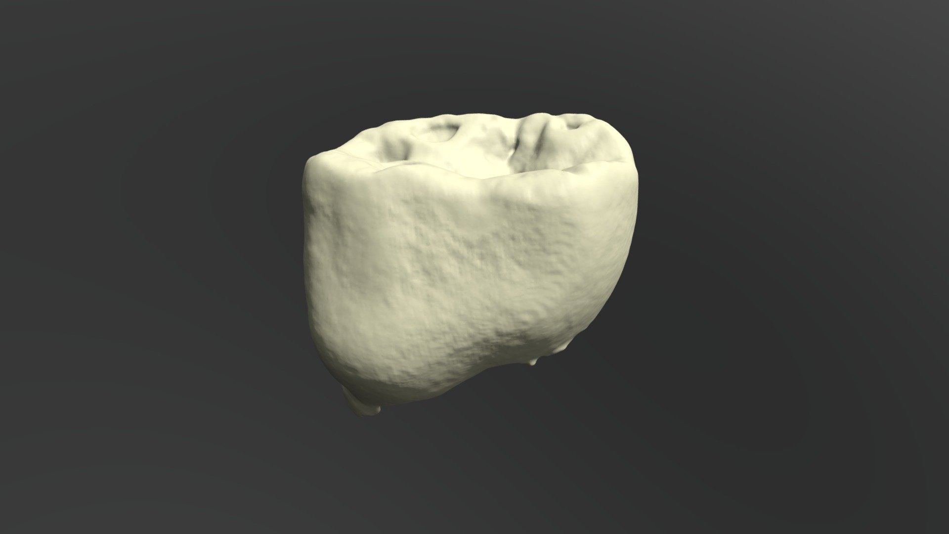 Deciduous Mandibular Molar - 3D model by Alexander Jon Cresswell-Boyes ...