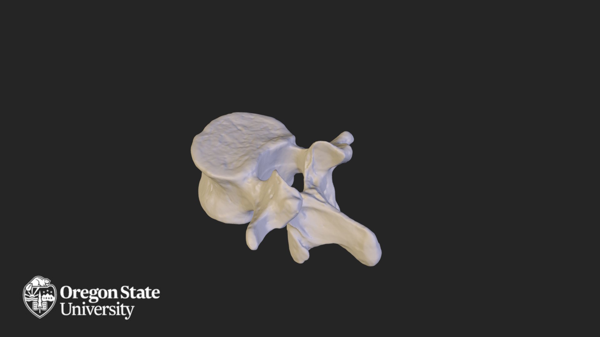 Lumbar vertebra - L1