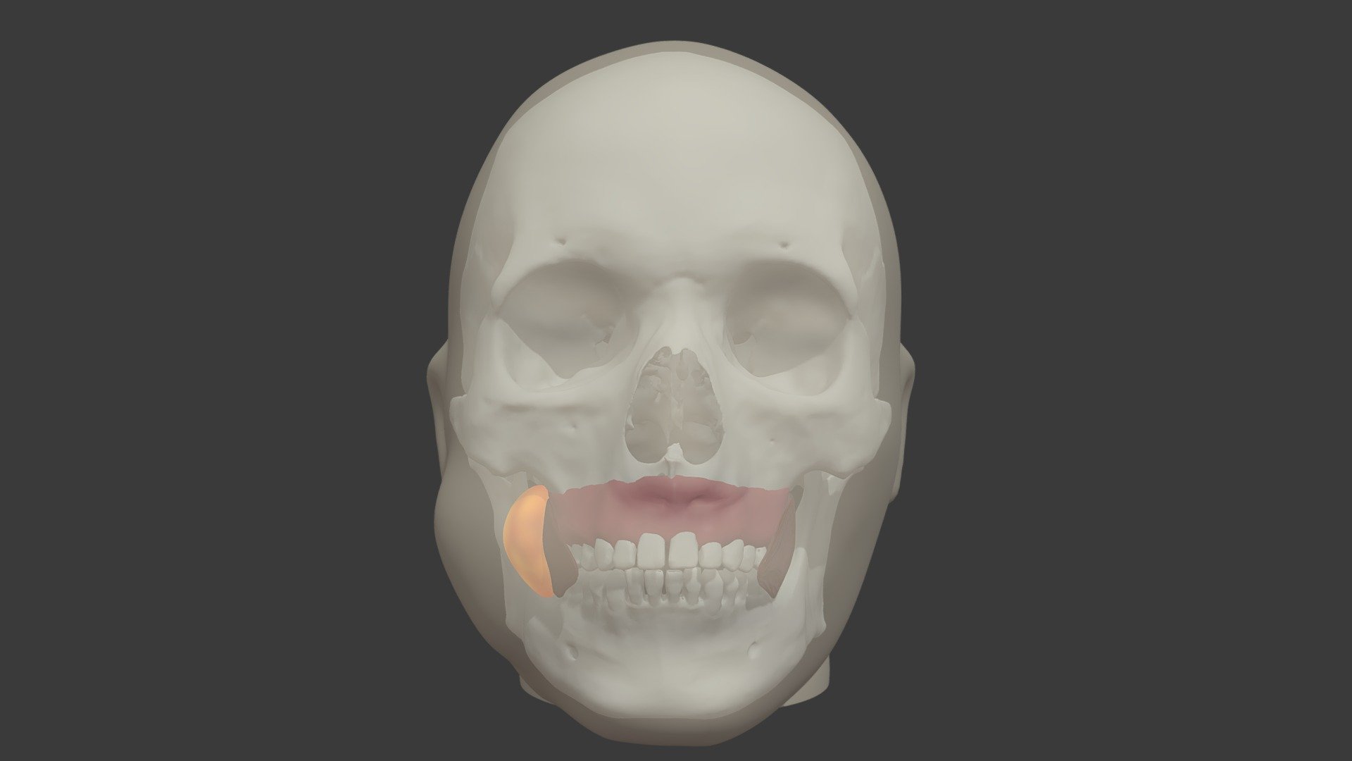 Stage 5 Long Root Maxillary Dental Infection - 3D model by University ...