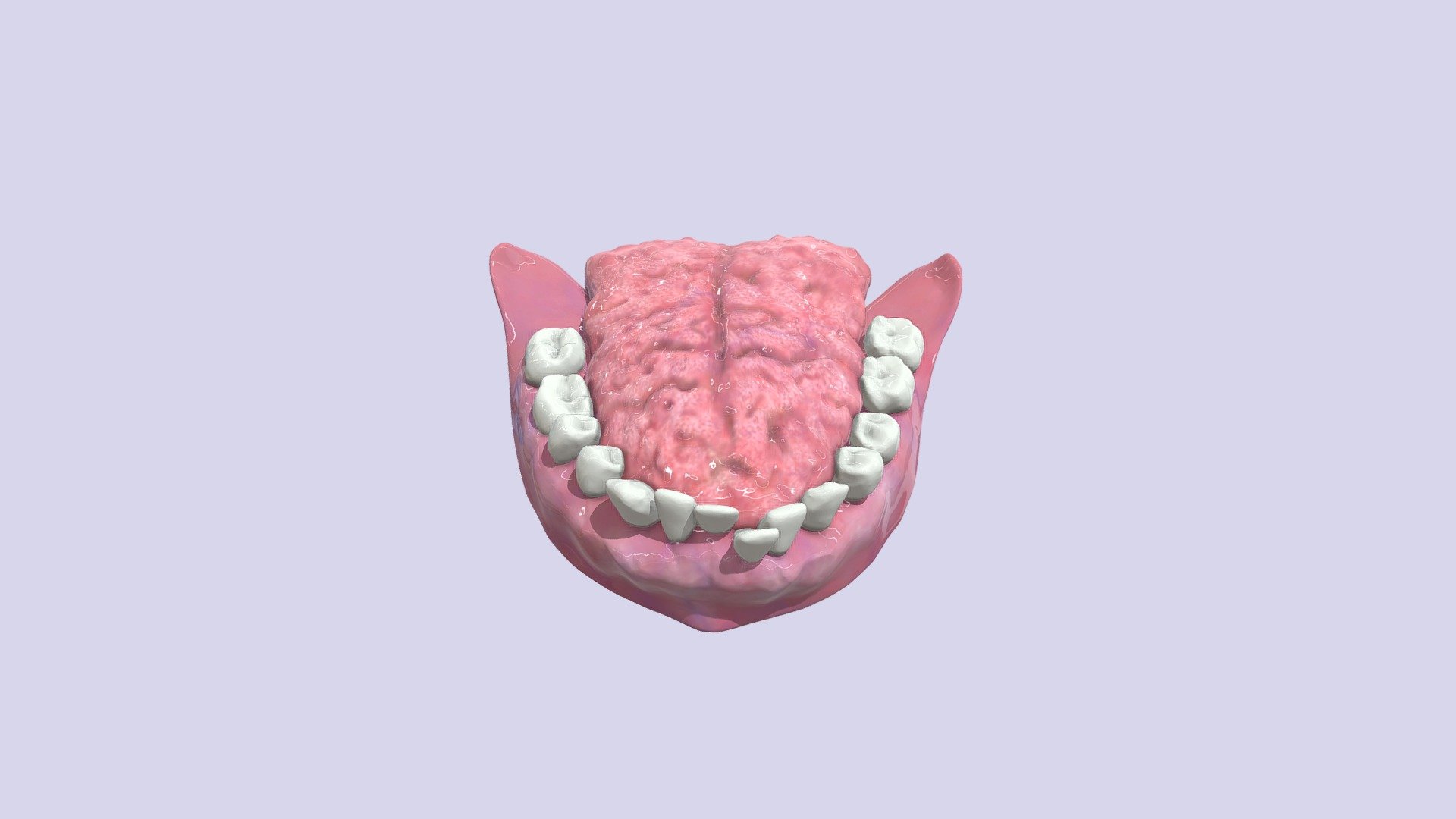 Tongue and Teeth of Down Syndrome 3D model by University of Dundee