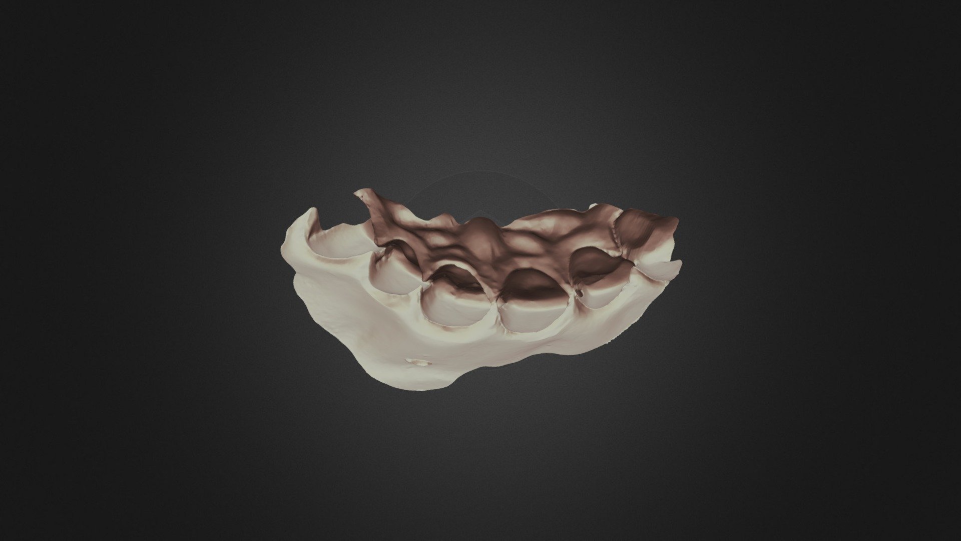 Group 11 Tooth 8 Fb Upper Jaw