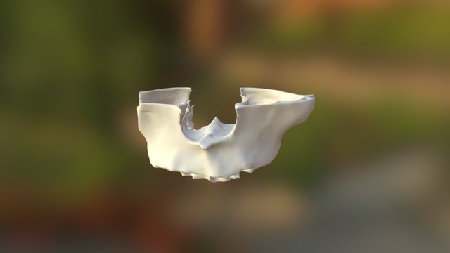 Pt YT Bone 3D Model