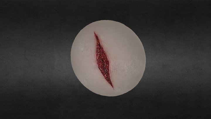 wound1 3D Model