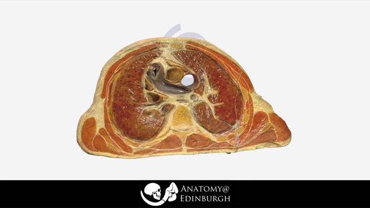 His-Steger Cast T3 - AHA1 Annotations 3D Model