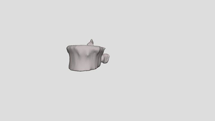 Segmentation_vertebrae 3D Model