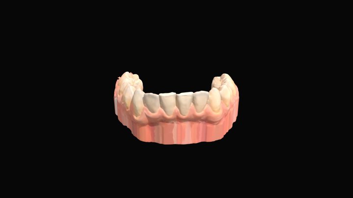 Caso practico resuelto- Arcada inferior 3D Model