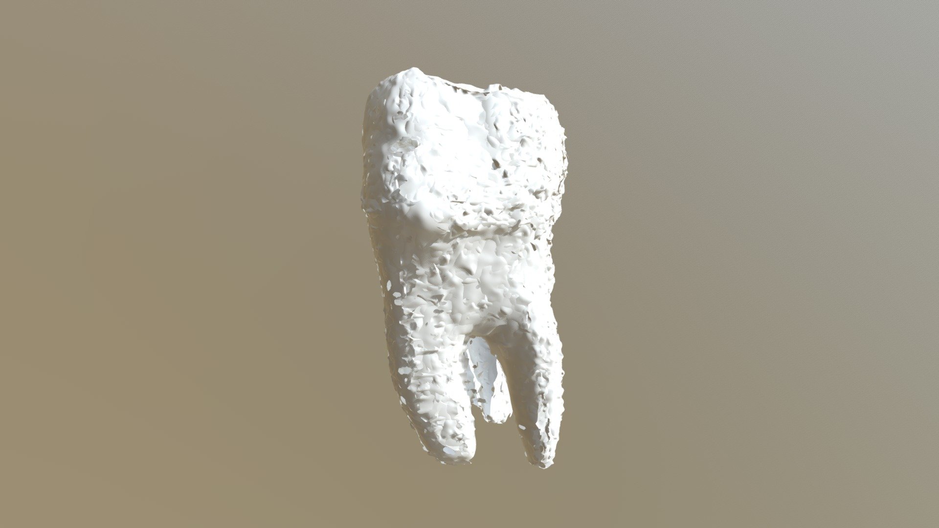 Tooth 2 Upper
