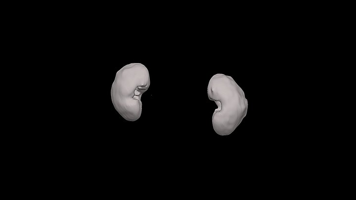 Segmentation_1_Kidney 3D Model