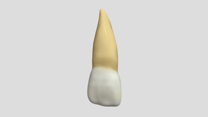 Maxillary Central Incisor (Right)