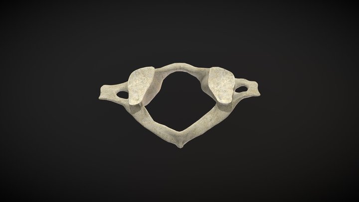 Vertebra Atlas / Atlas vertebrae – Free 3D Model STL