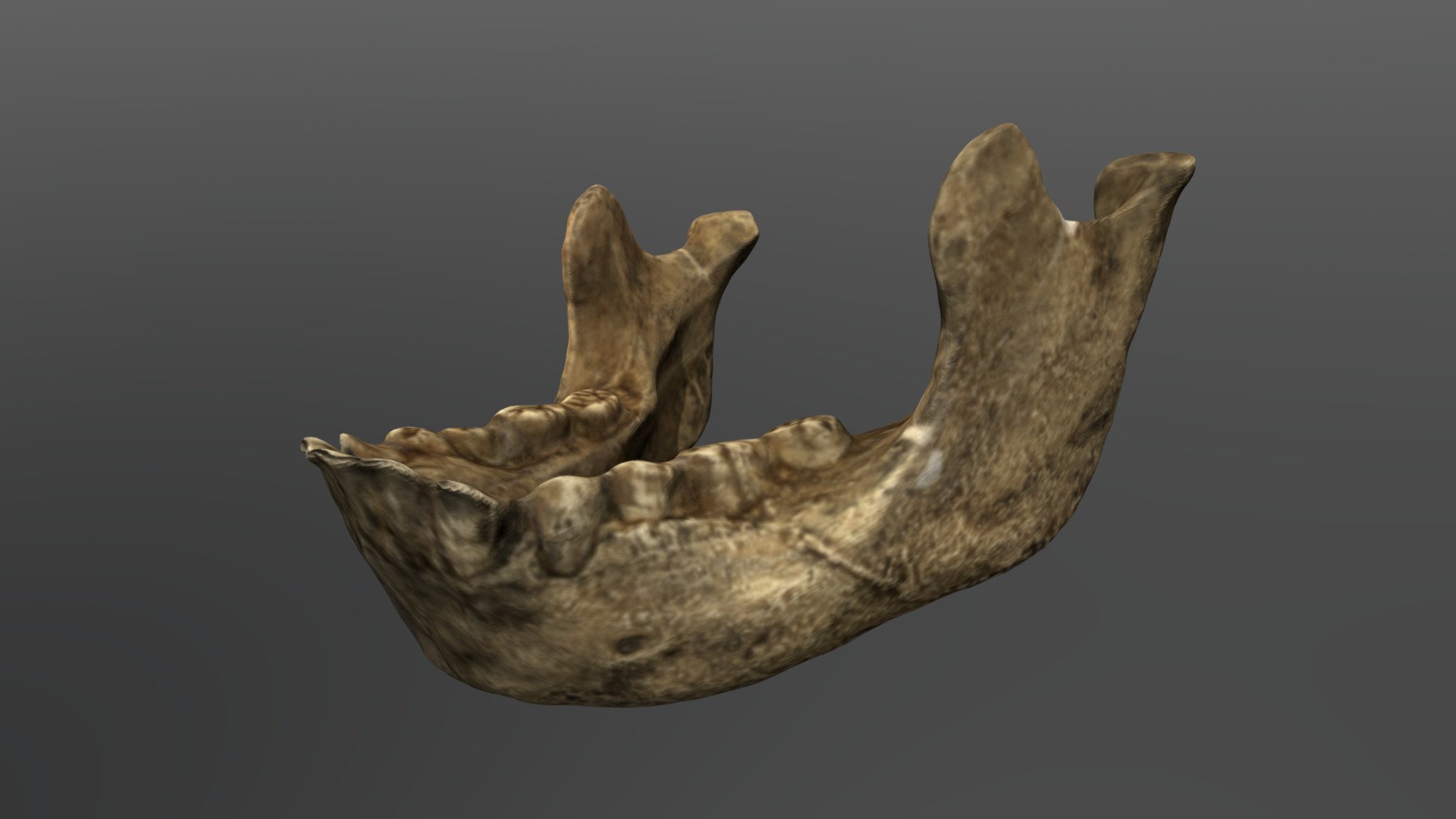 Homo erectus Mandible (NMWT 15000)