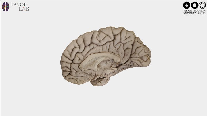 Right hemisphere - medial and inferior surfaces 3D Model