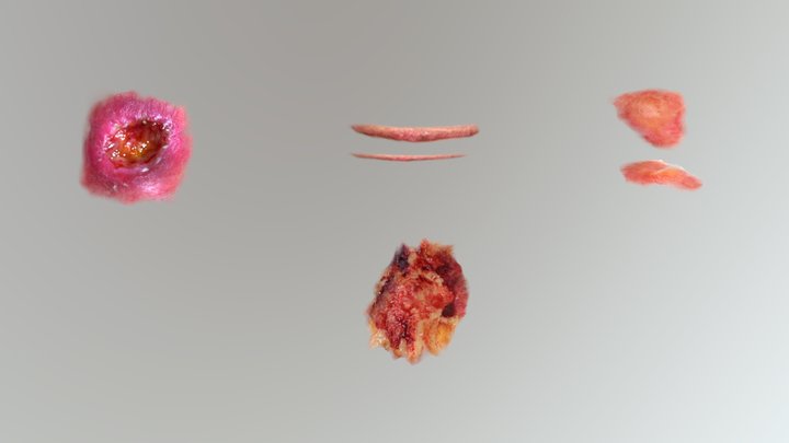 Heridas 3D Model