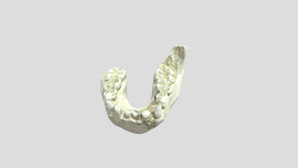 Taung Child - Mandible