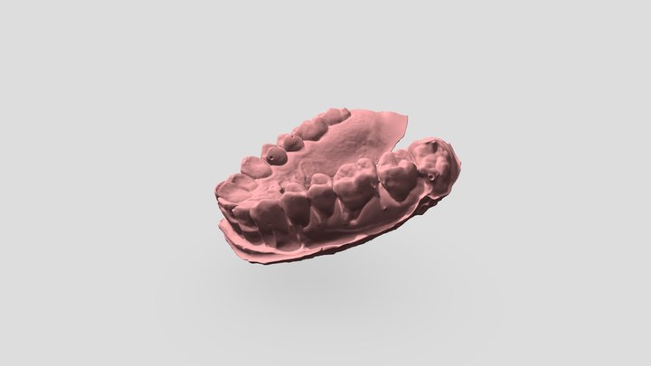 Teeth Cast 3D Scan 3D Model