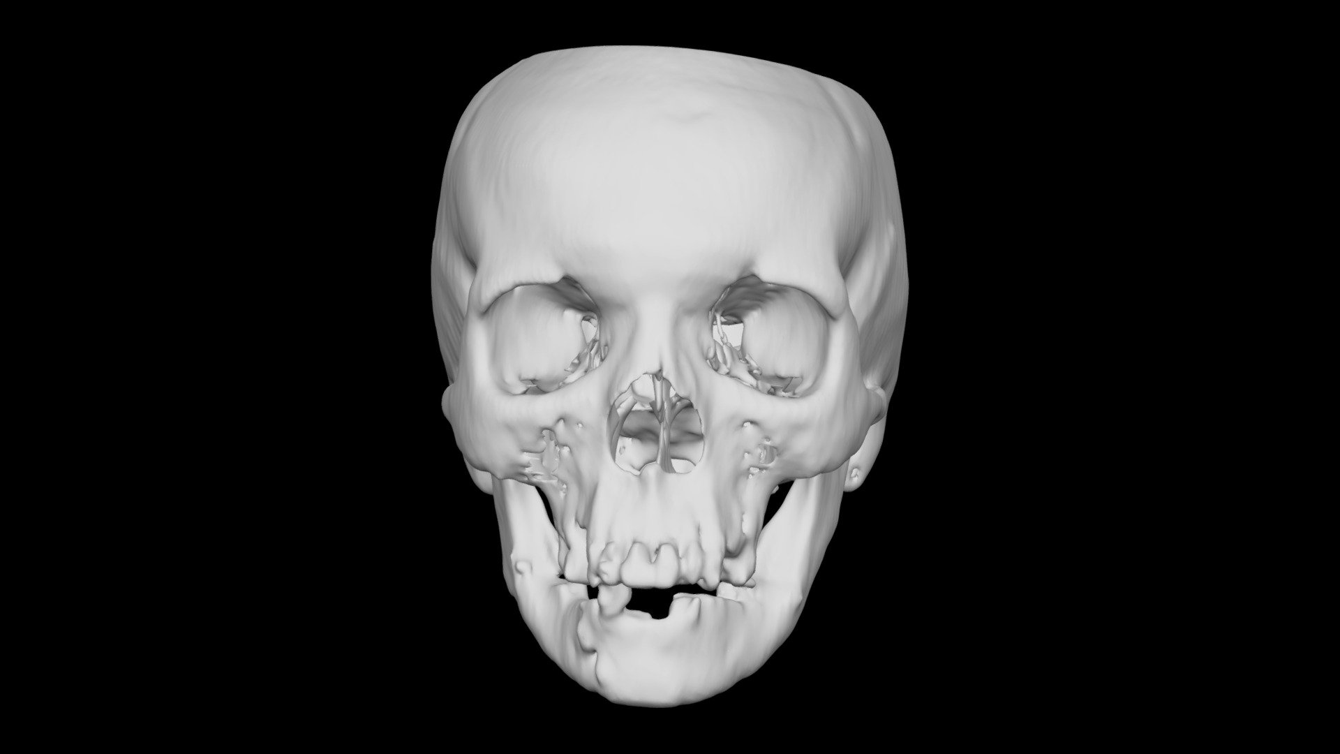Skull Female 71yo
