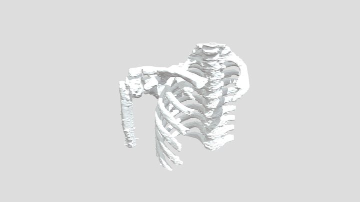 CT 3D SCAN CASE 03_NT HONG (ALL) 3D Model