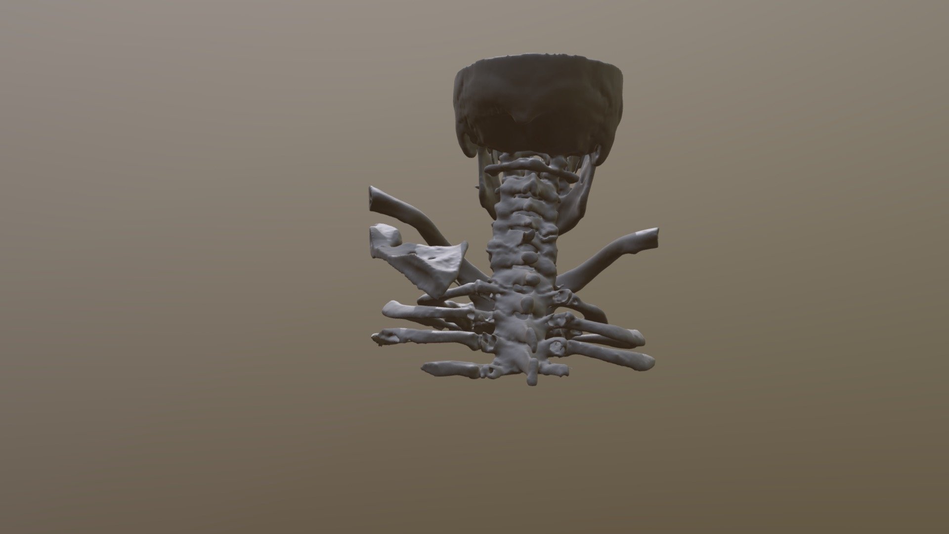 REAL C-SPINE