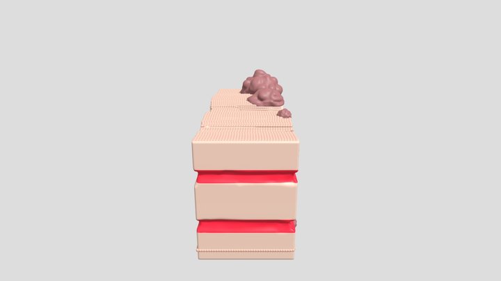 Laboratório do Câncer - Metástase 3D Model