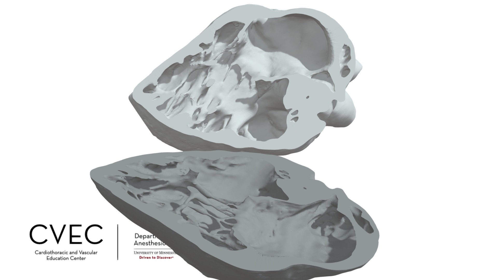 TEE TG Right Ventricular Inflow - Download Free 3D model by CVEC ...