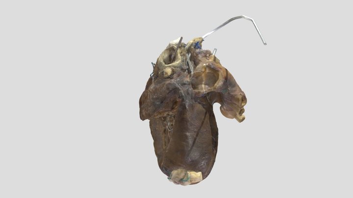 Transposition of Great Arteries_A79112 3D Model