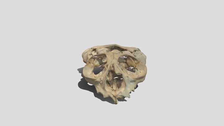 Anencephalus1 3D Model