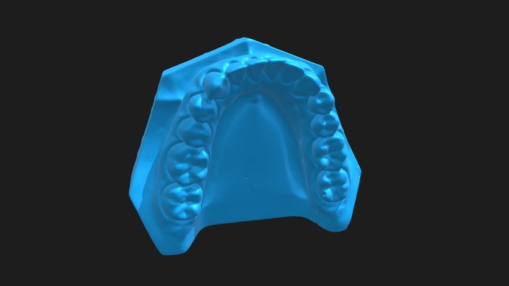 Dental Model – Modello 3D gratuito STL