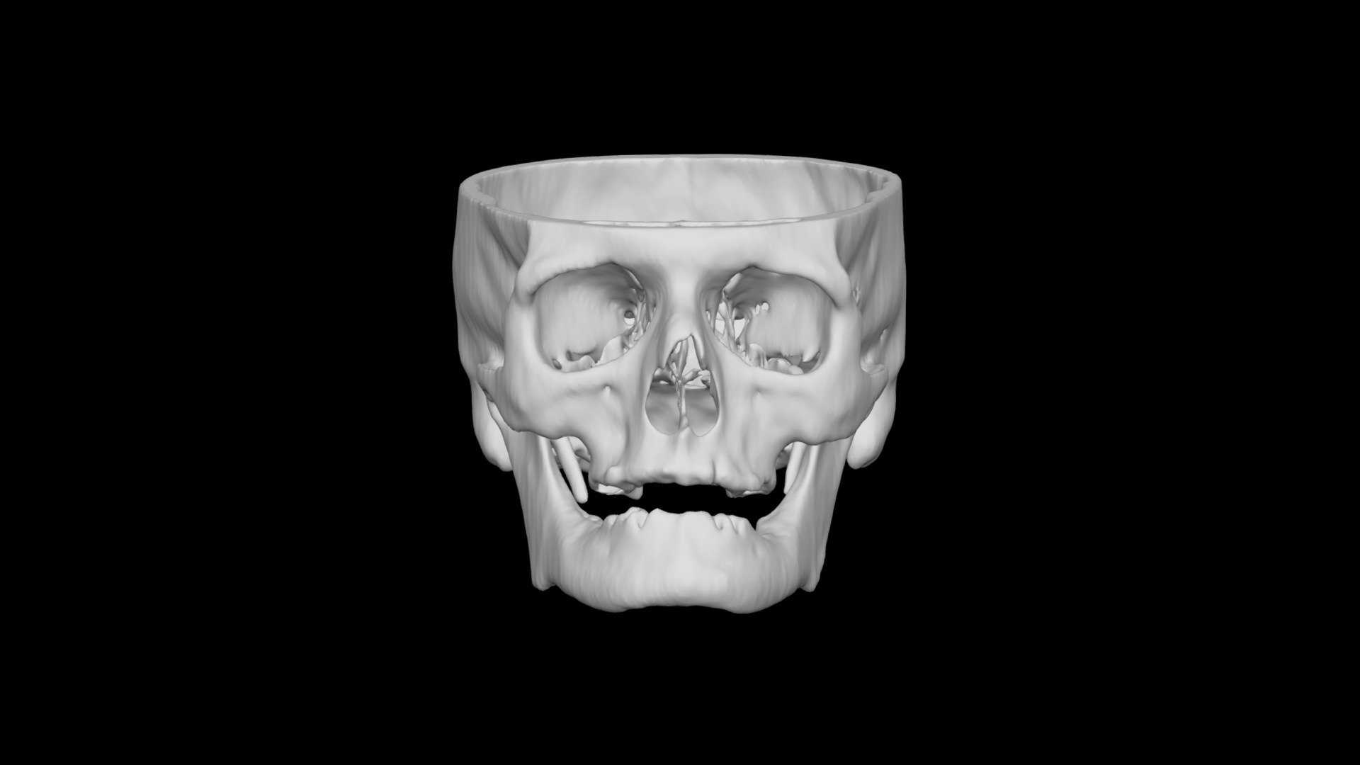 Skull Male 48yo