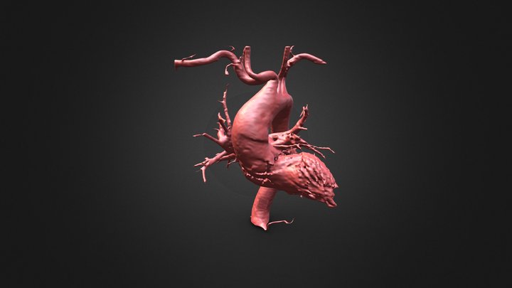 Angiographic Phase CT Scan of Aorta 3D Model