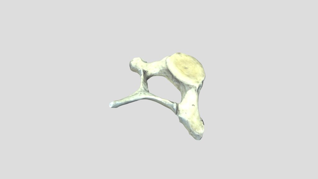 Cervical Vertebra Dolphin