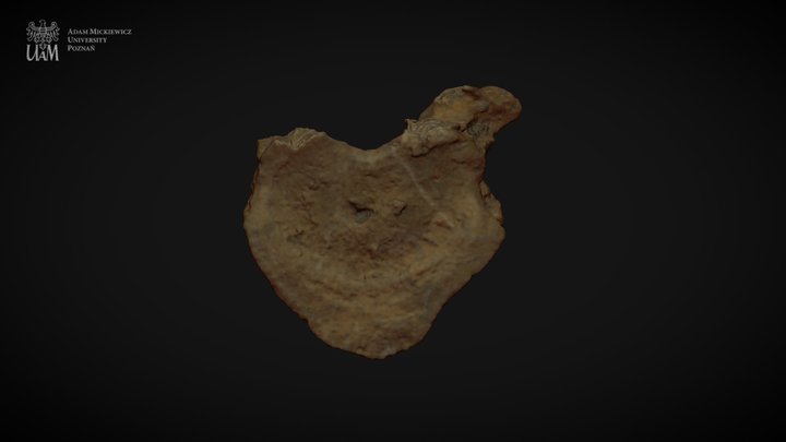 Achondroplastic dwarf - T11 3D Model