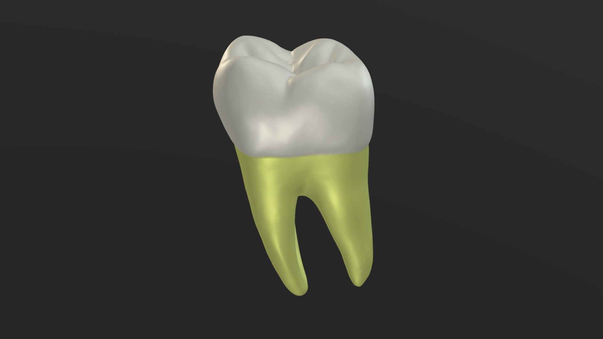 Mandibular Permanent Left Second Molar