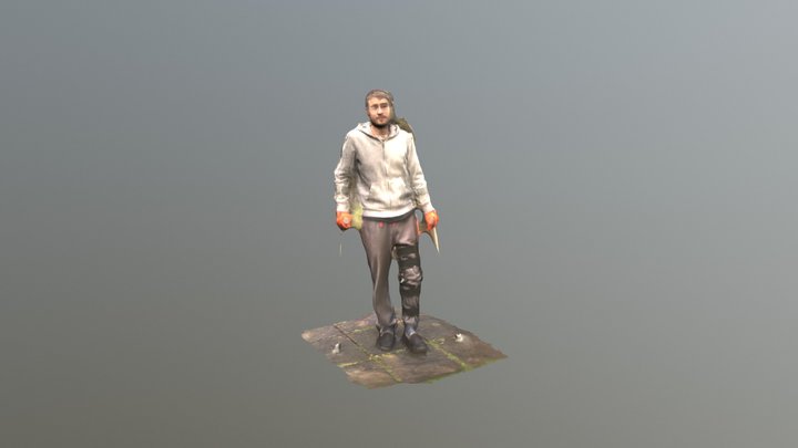 Broken Leg 3D Model