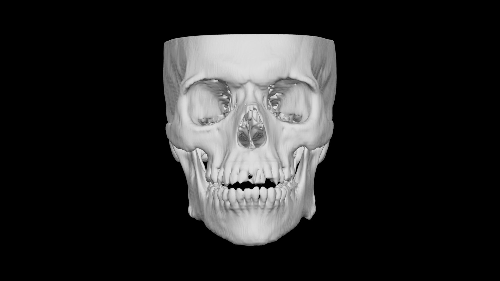 Skull Male 49yo
