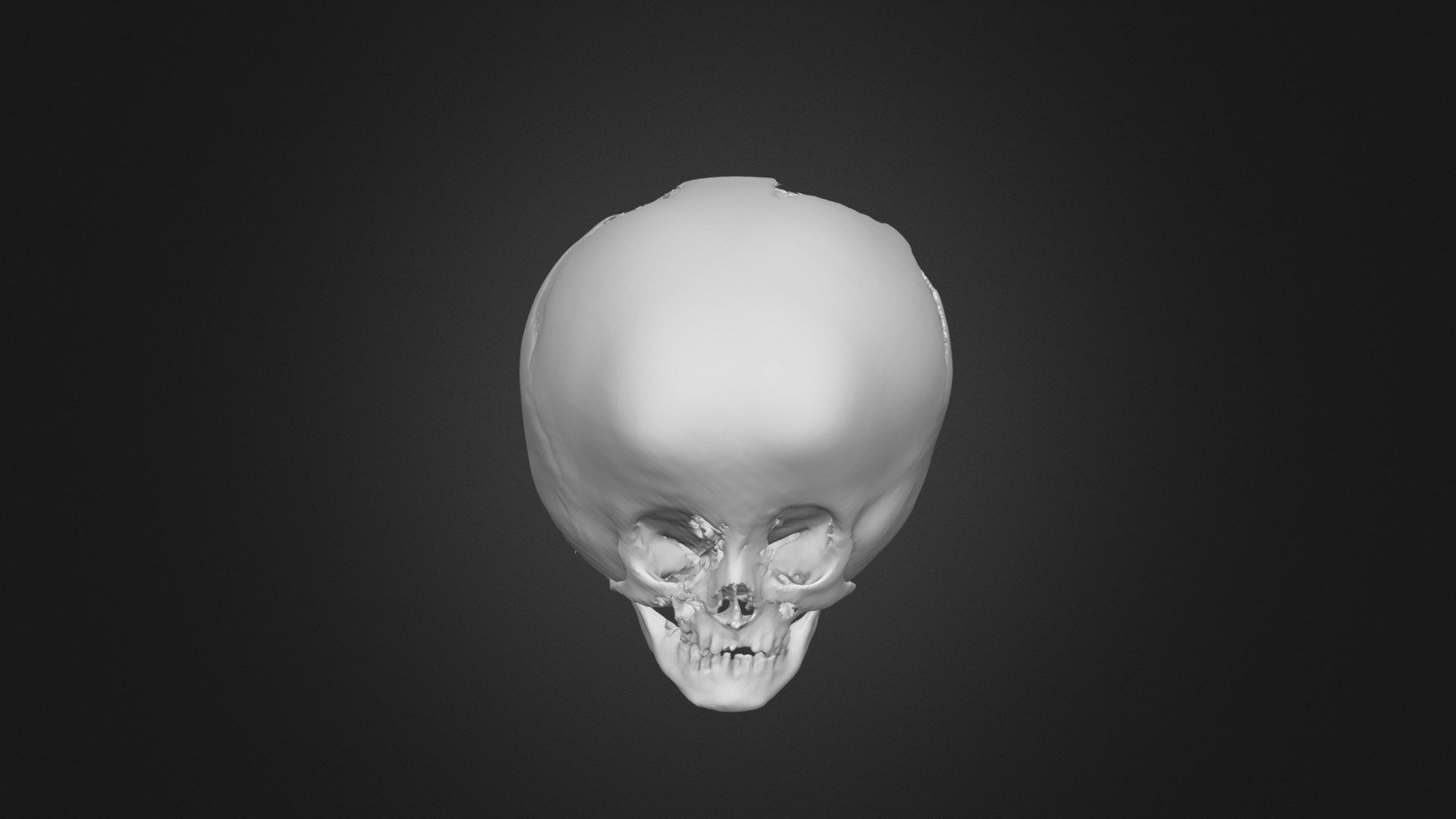 Skull