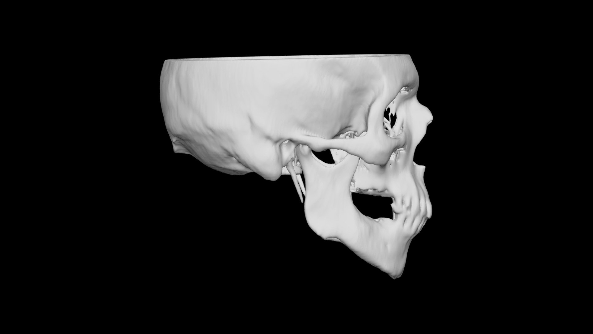 Skull Male 64yo