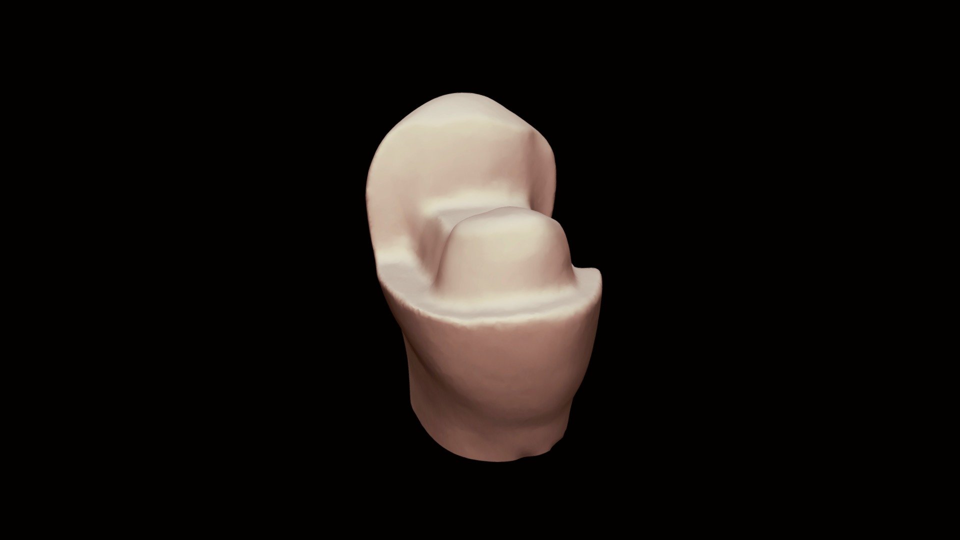 12 Ceramic Onlay 3D model by VCU Restorative Dentistry (sodgp) [b0be61d] Sketchfab