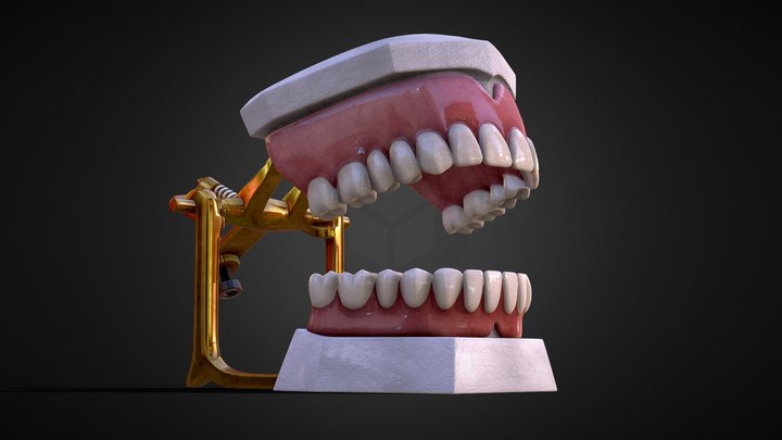 Dental Prosthesis 3D Model