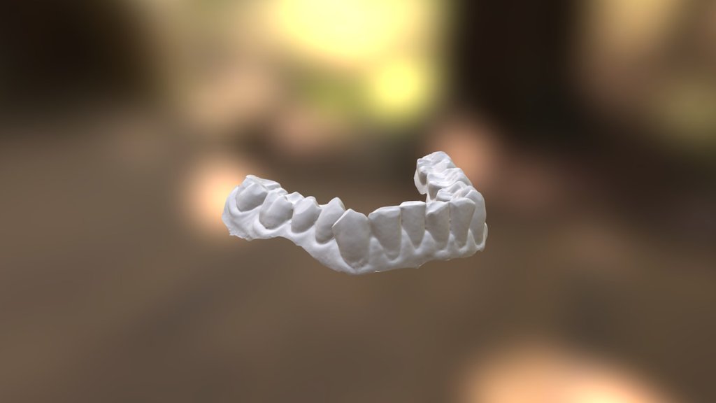 Helen Lower Jaw
