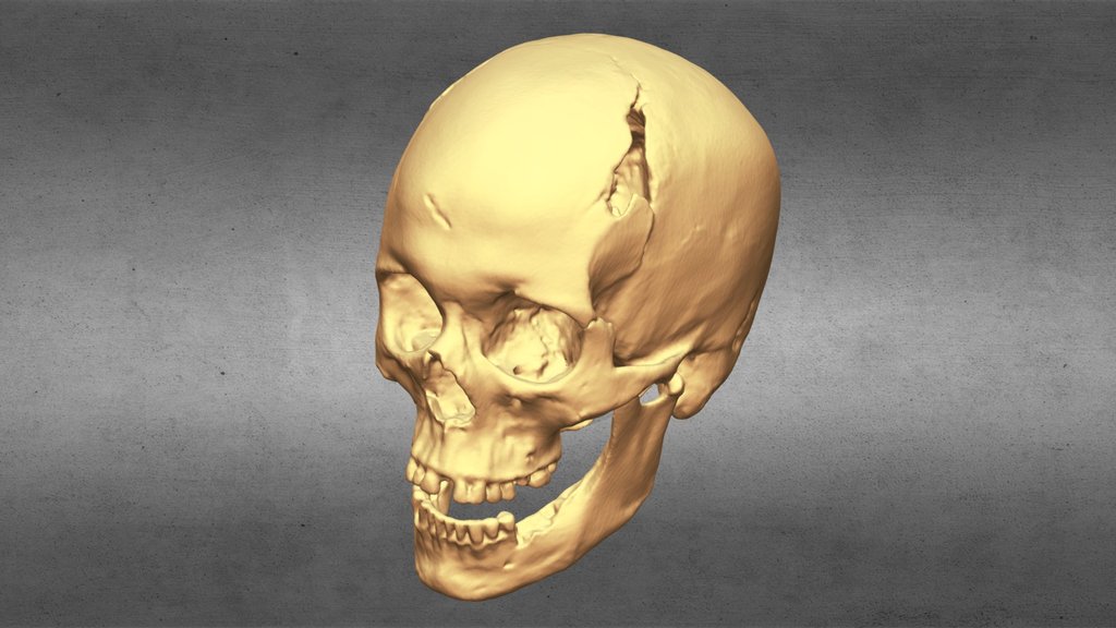 King Richard III Skull