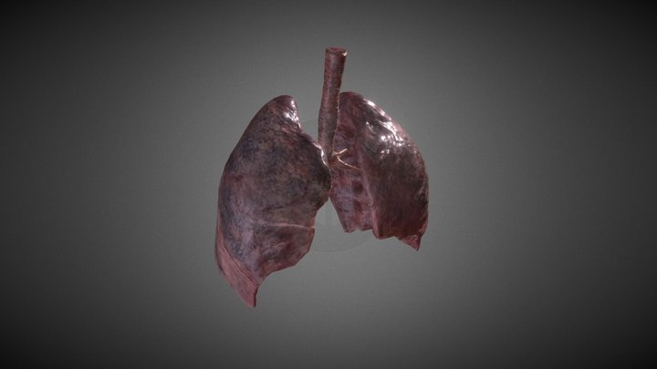 Smoker's Lungs (animated) 3D Model