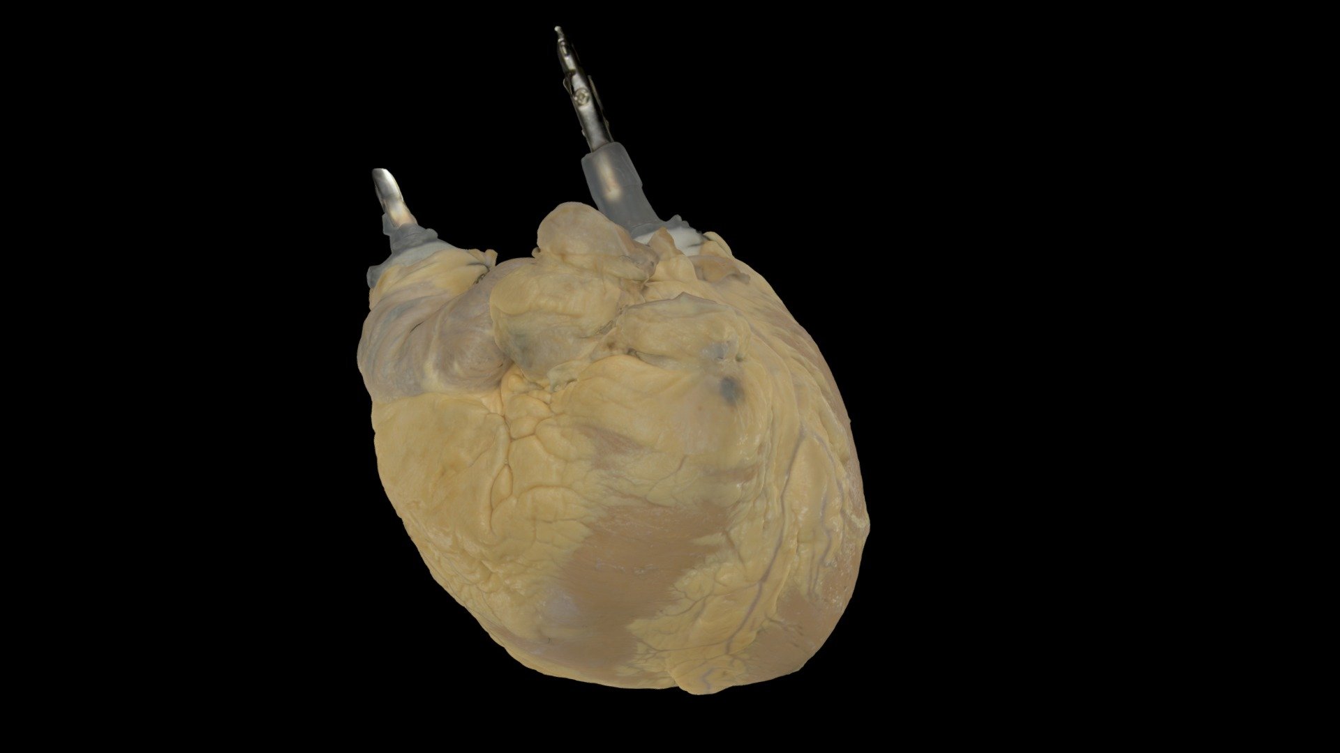 Fixed Adult Human Heart