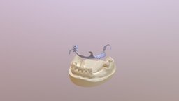 Maxillary RPD insertion animation - 3D model by Ahmed Mahrous ...