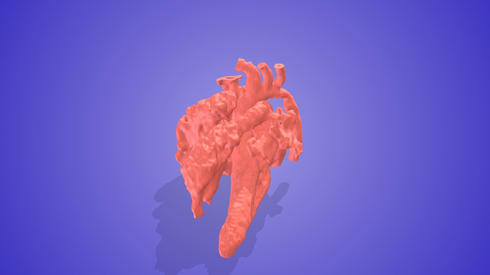 Hypoplastic Transverse Arch