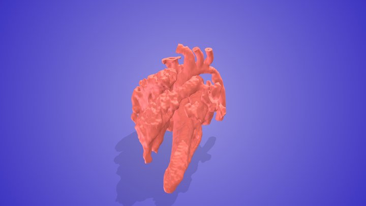 Hypoplastic Transverse Arch 3D Model