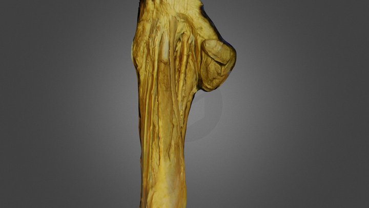 Anterior upper thigh musculature 3D Model