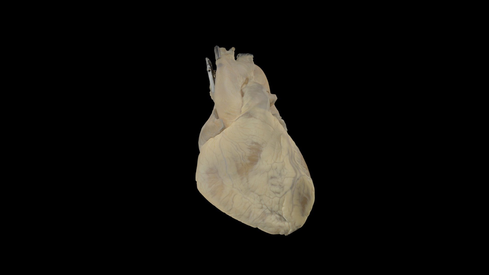 Fixed Human Heart with long Aorta - Download Free 3D model by ...