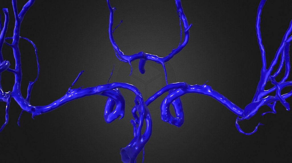 Normal cerebral arteries N019