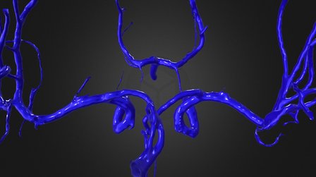 Normal cerebral arteries N019 3D Model